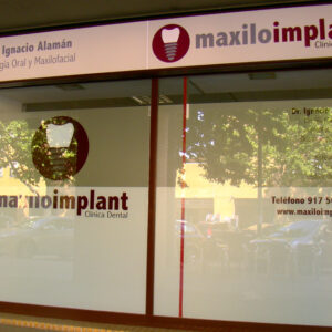 maxilo-implant015