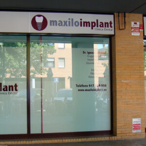 maxilo-implant016